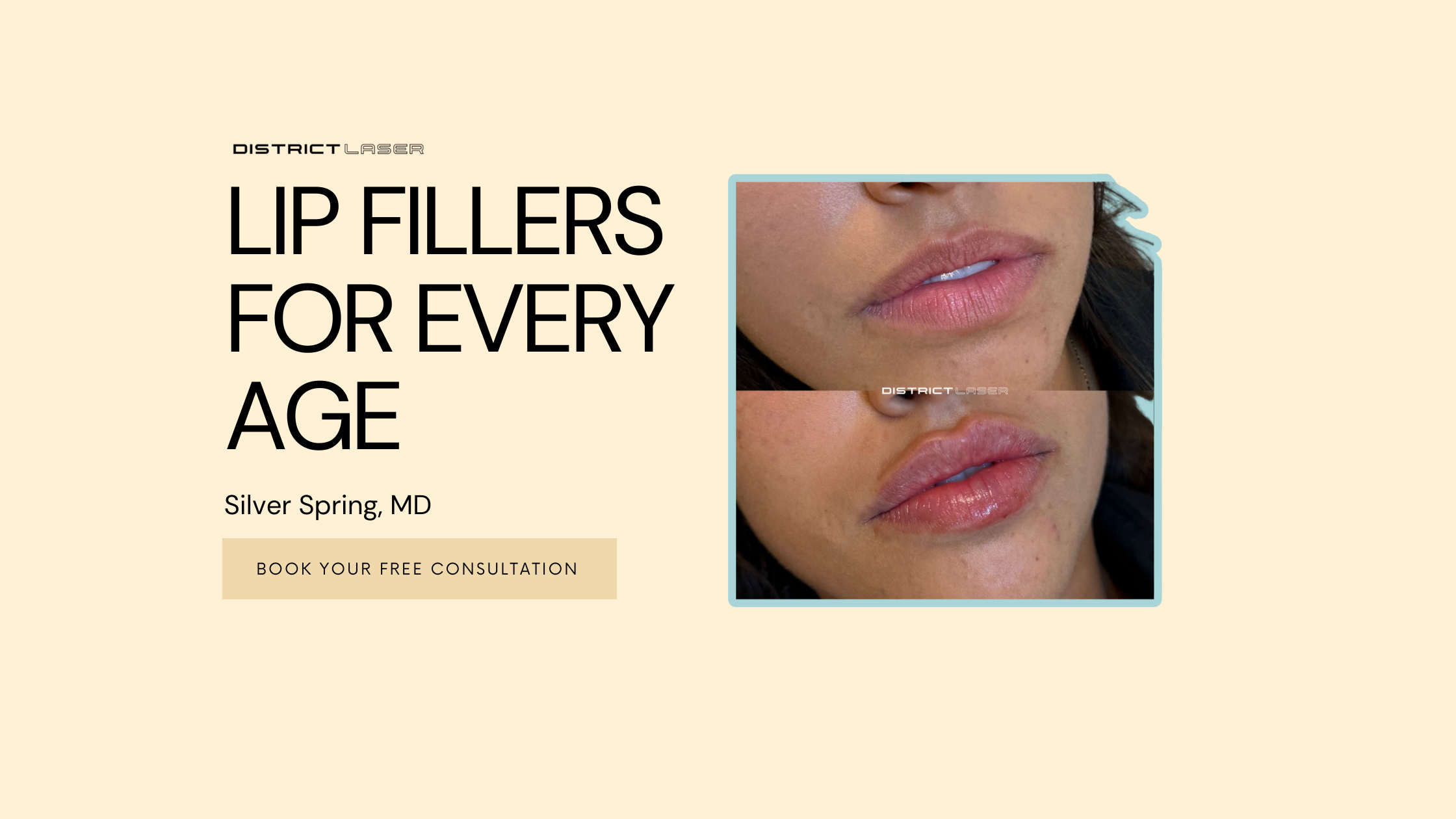 Lip Fillers for Every Age: Silver Spring's Guide to Ageless Beauty